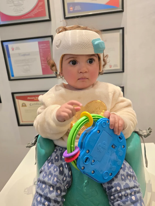 Bebê sorridente usando capacete craniano (órtese craniana) leve e confortável